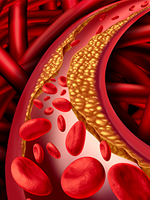 Increased Attention to Cardiovascular Events in  DLBCL Warranted