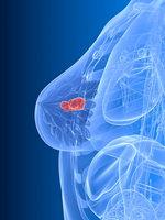 CDK4/CDK6 Inhibitors Show Promise in Advanced Postmenopausal Breast Cancer